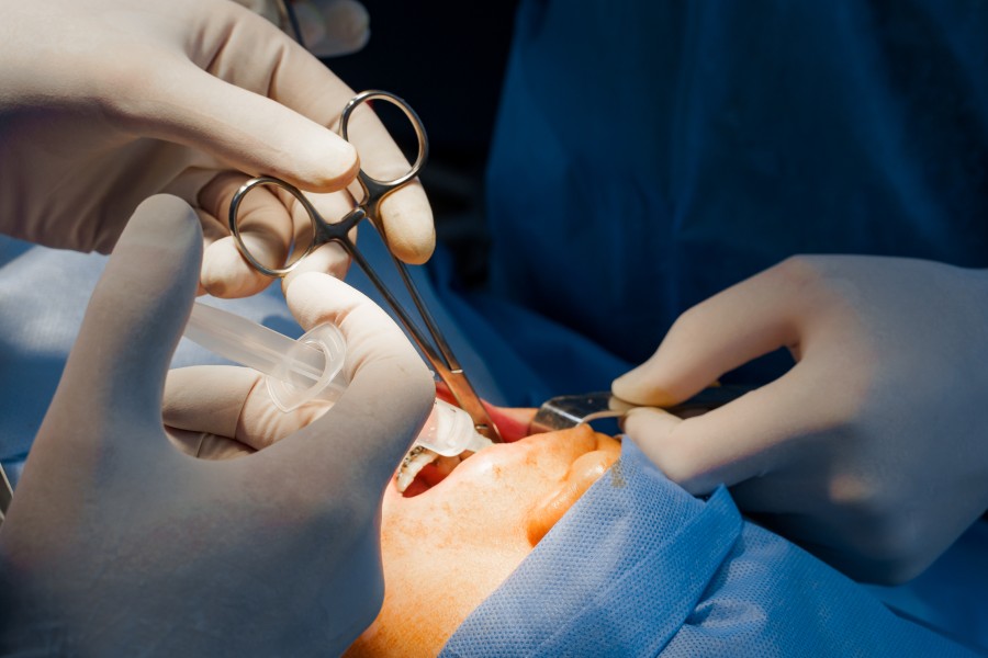 Oral & Maxillofacial Surgery
