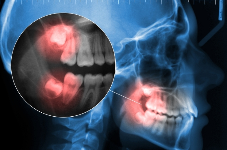 Sravanthi Multi Speciality Dental Hospital