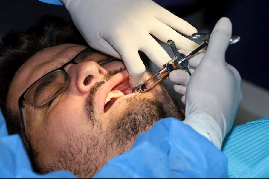 Peridontal flap surgery