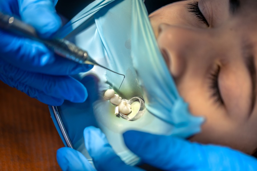 tooth extraction